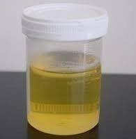 Gaumutra (Cow urine)